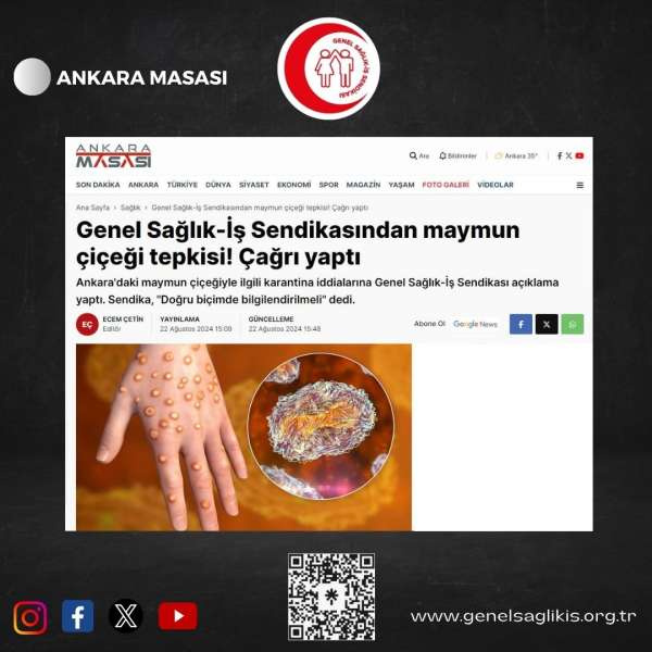 Genel Sağlık-İş Sendikasından maymun çiçeği tepkisi! Çağrı yaptı